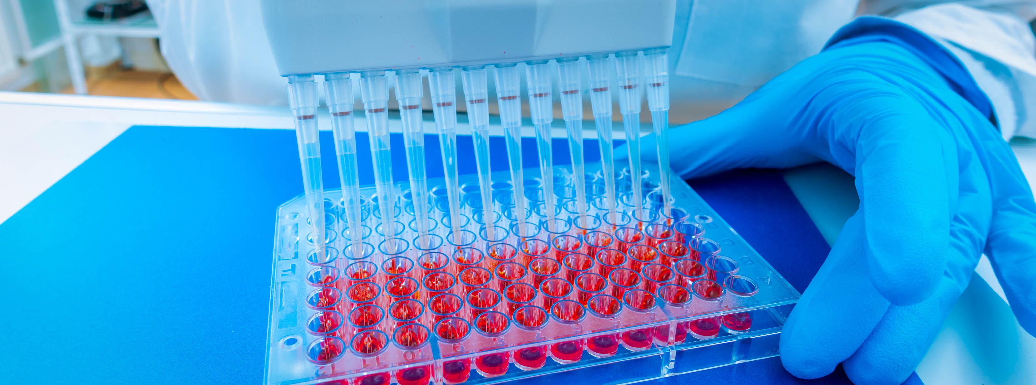 UZ Leuven en KU Leuven investeren 14 miljoen euro in nieuwe faciliteit voor cel- en gentherapie 