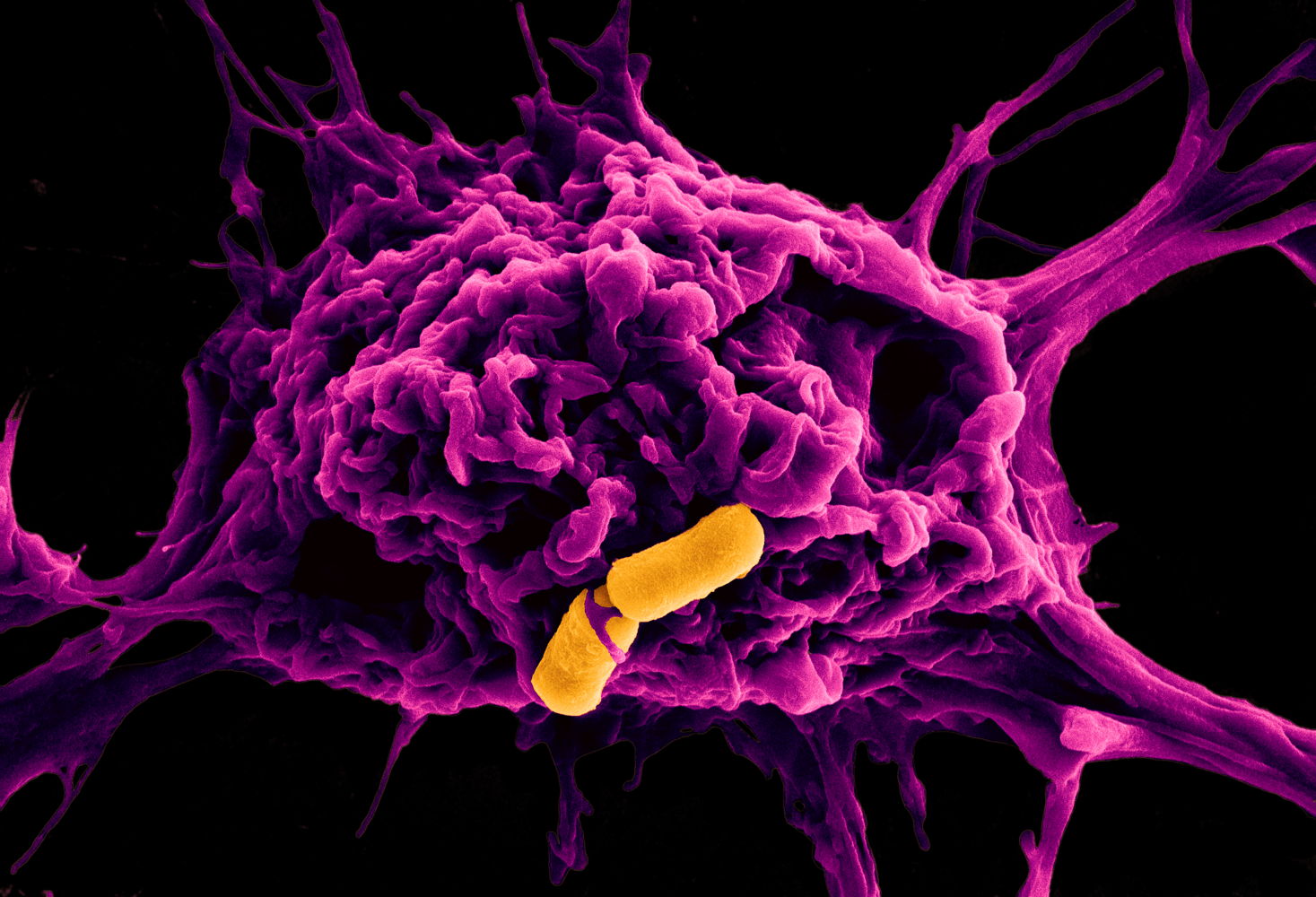 “A fight between an immune cell (purple) and two rod-shaped stomach bugs (yellow)”. Credit: ANU