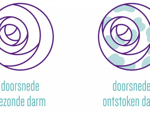 Kleine organismen, grote impact: Hoe microben ons helpen in de strijd tegen inflammatoire darmziekten