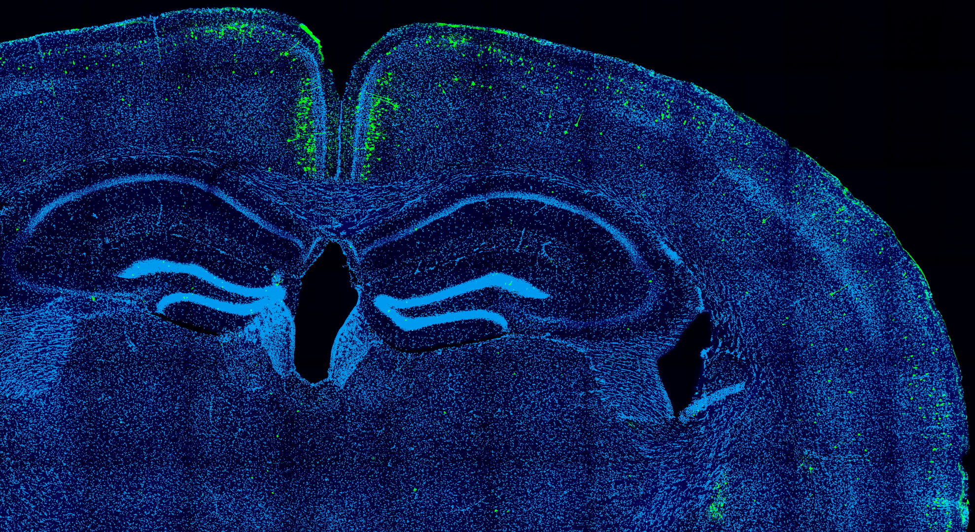 Chicken regulatory DNA sequence activating gene expression in mouse brain neurons, as predicted by the deep learning models.