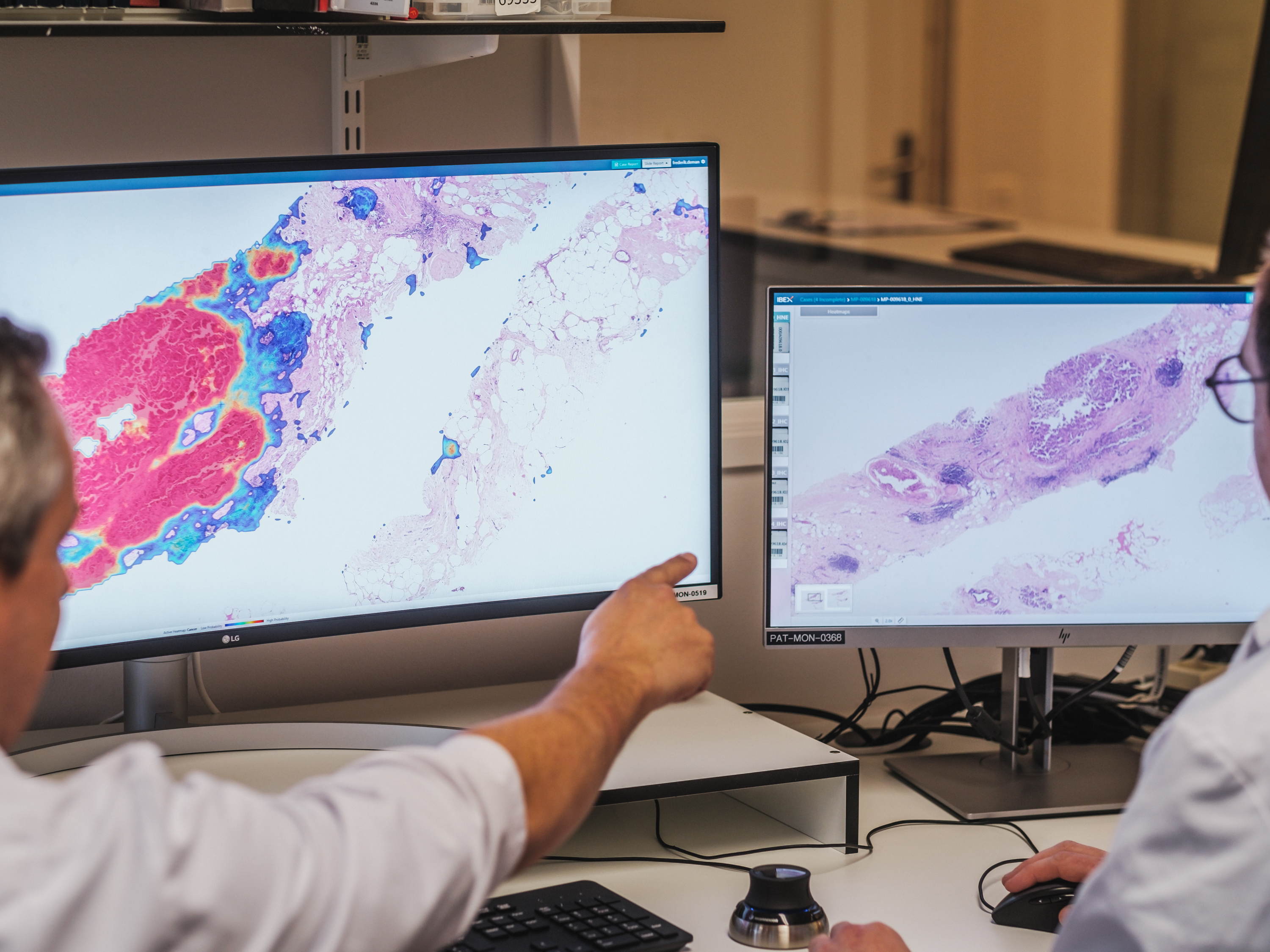 Benelux primeur: ZNA en GZA Ziekenhuizen gebruiken slimme software voor diagnose kanker