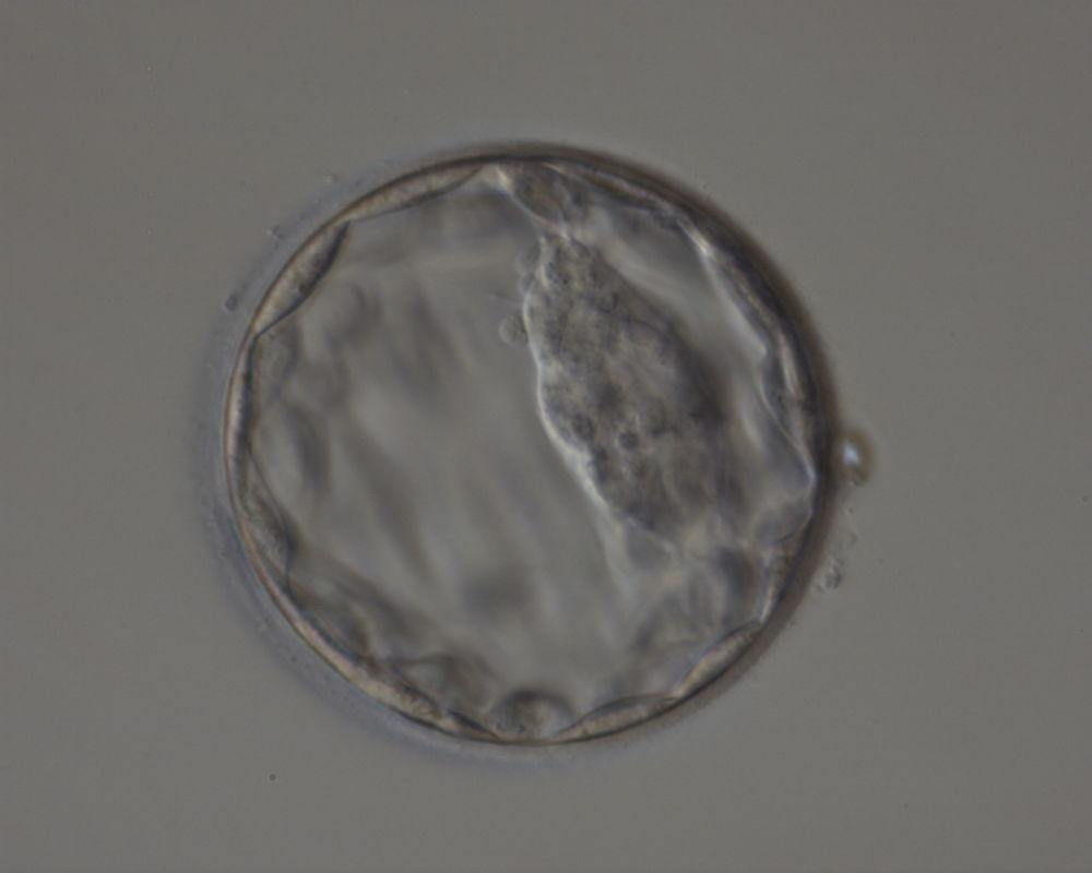 Foto van een blastocyst, een 5-dagen oud embryo.