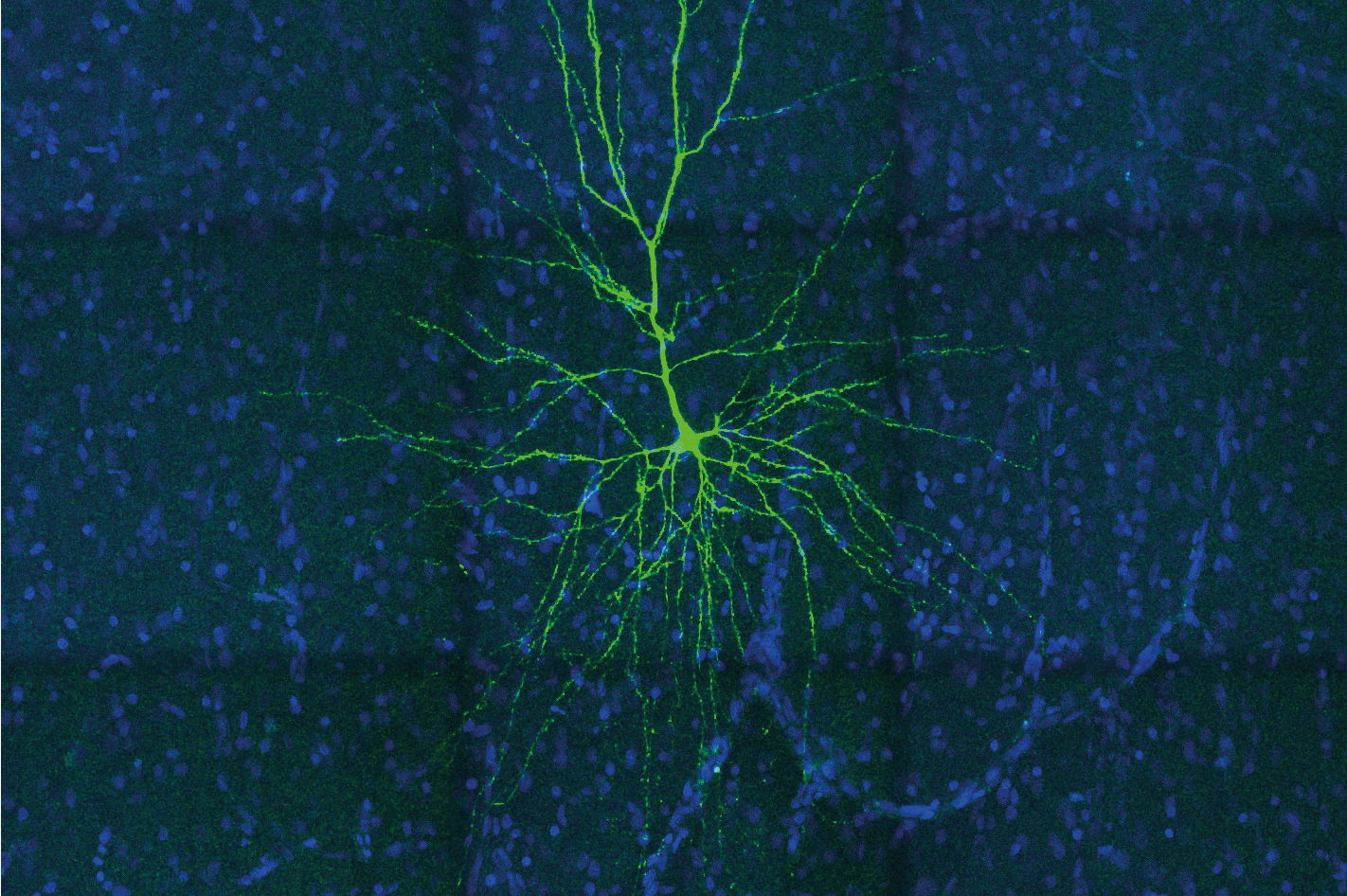 Neuron in de menselijke hersenschors
