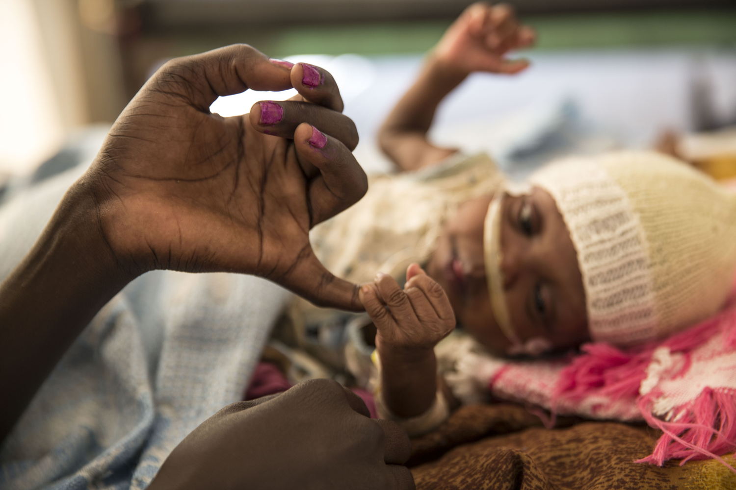 Mary James, 4 mois, a été admise pour la troisième fois dans l’hôpital MSF de Malakal, au Soudan du Sud. Elle souffre de la tuberculose. ©Anna Surinyach/MSF