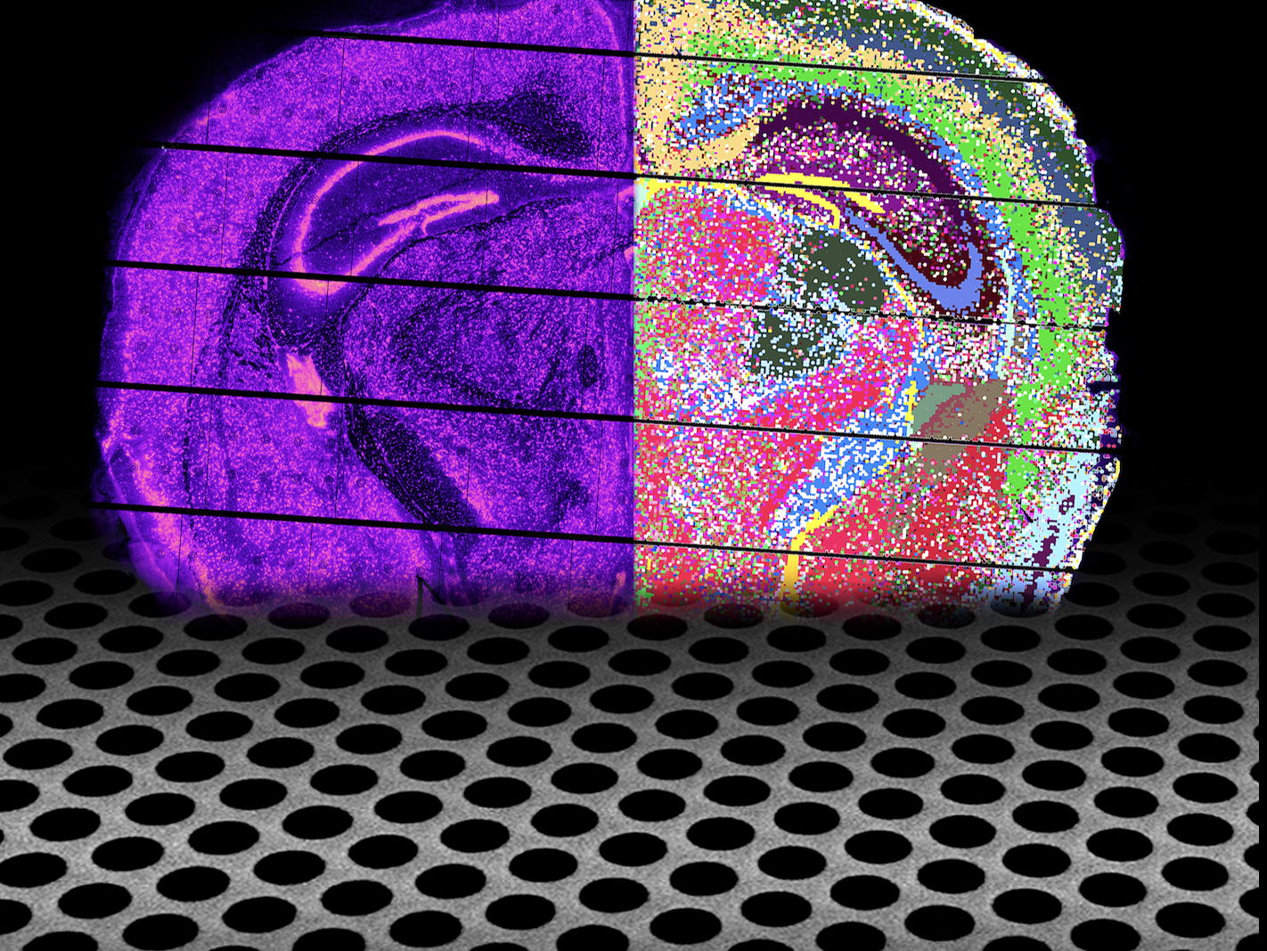 New open-source platform for high-resolution spatial transcriptomics 
