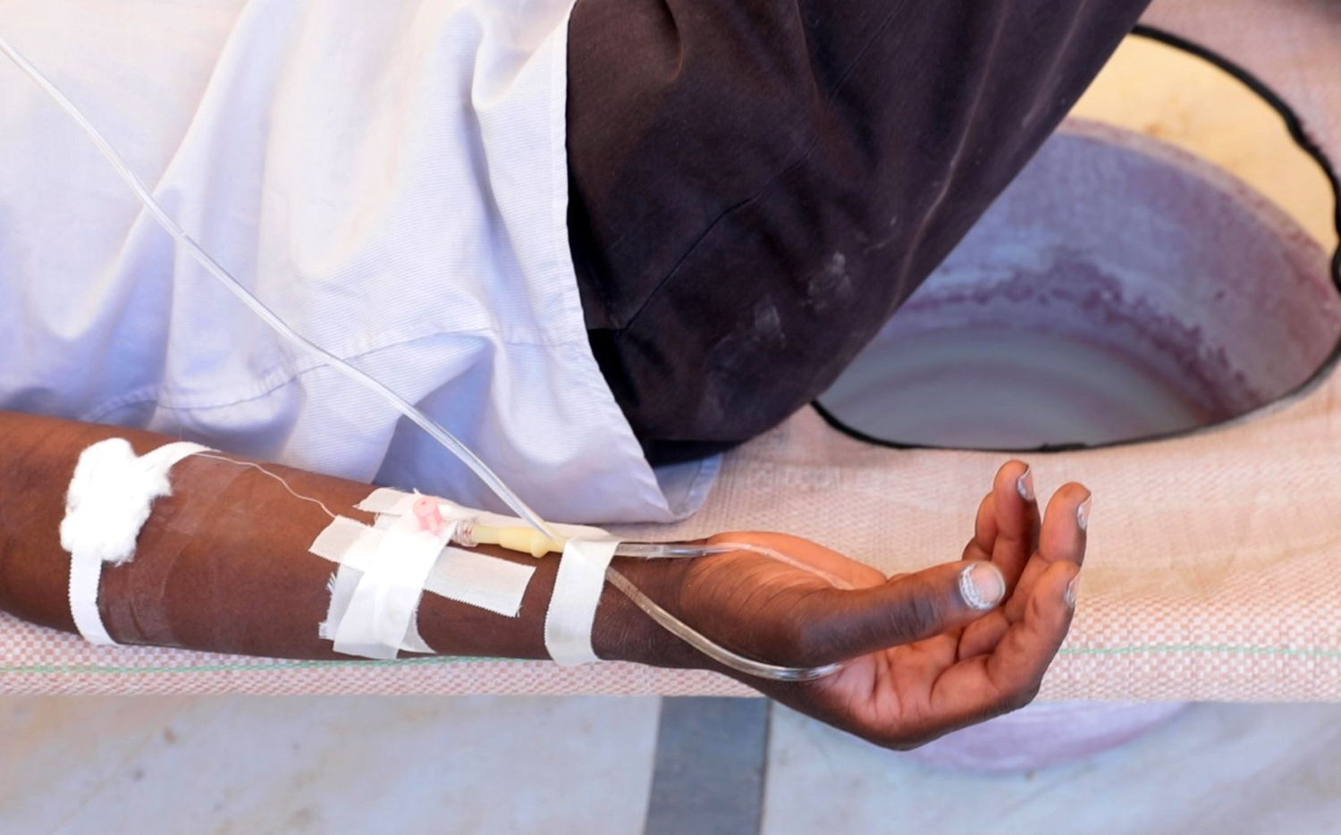A cholera patient is rehydrated with oral rehydration solution and intravenous fluids at the Glenview Cholera Treatment Centre, Harare set up by MSF in support of health authorities. Fluids are the main treatment for cholera. Photographer: Marion Mossing