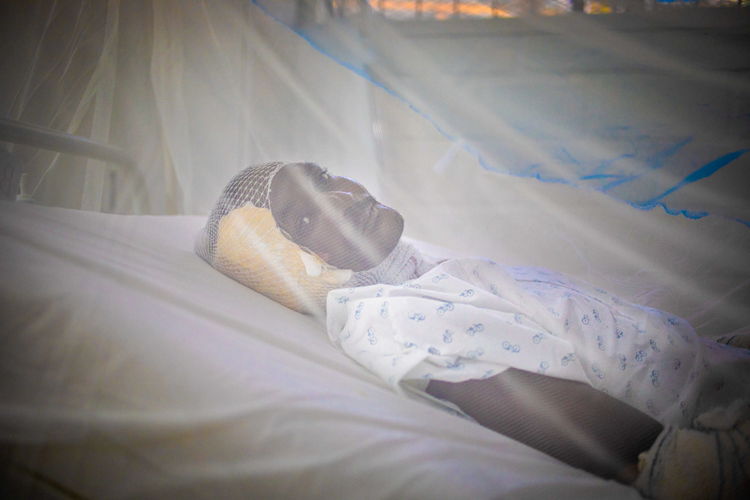 Following the explosion of a fuel tanker in Mirogôane on 14 September, many injured people were treated at various MSF facilities. Six patients are currently being treated at the MSF trauma hospital in Carrefour. MSF teams are working hard to provide them with the necessary care. One of them, Kenol Coman, has extensive severe burns on several parts of his body. | Date taken: 18/09/2024 | Photgrapher: Quentin Bruno Vanbergen | Location: Haiti