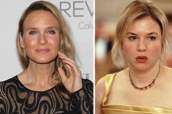 Koppen: botox (c) VRT