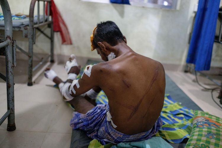 Kutupalong: Rohingya patient in MSF Kutupalong clinic. Credit: Antonio Faccilongo