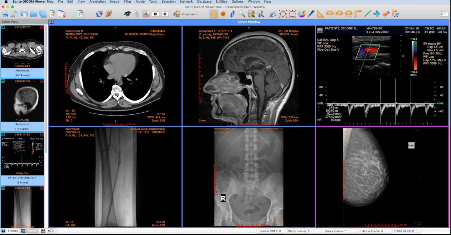 医療専門家はDICOM ビューア クライアントを使用して医療画像を表示および分析します。