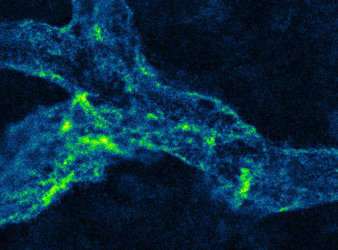 How autophagy shapes the lymphatic system