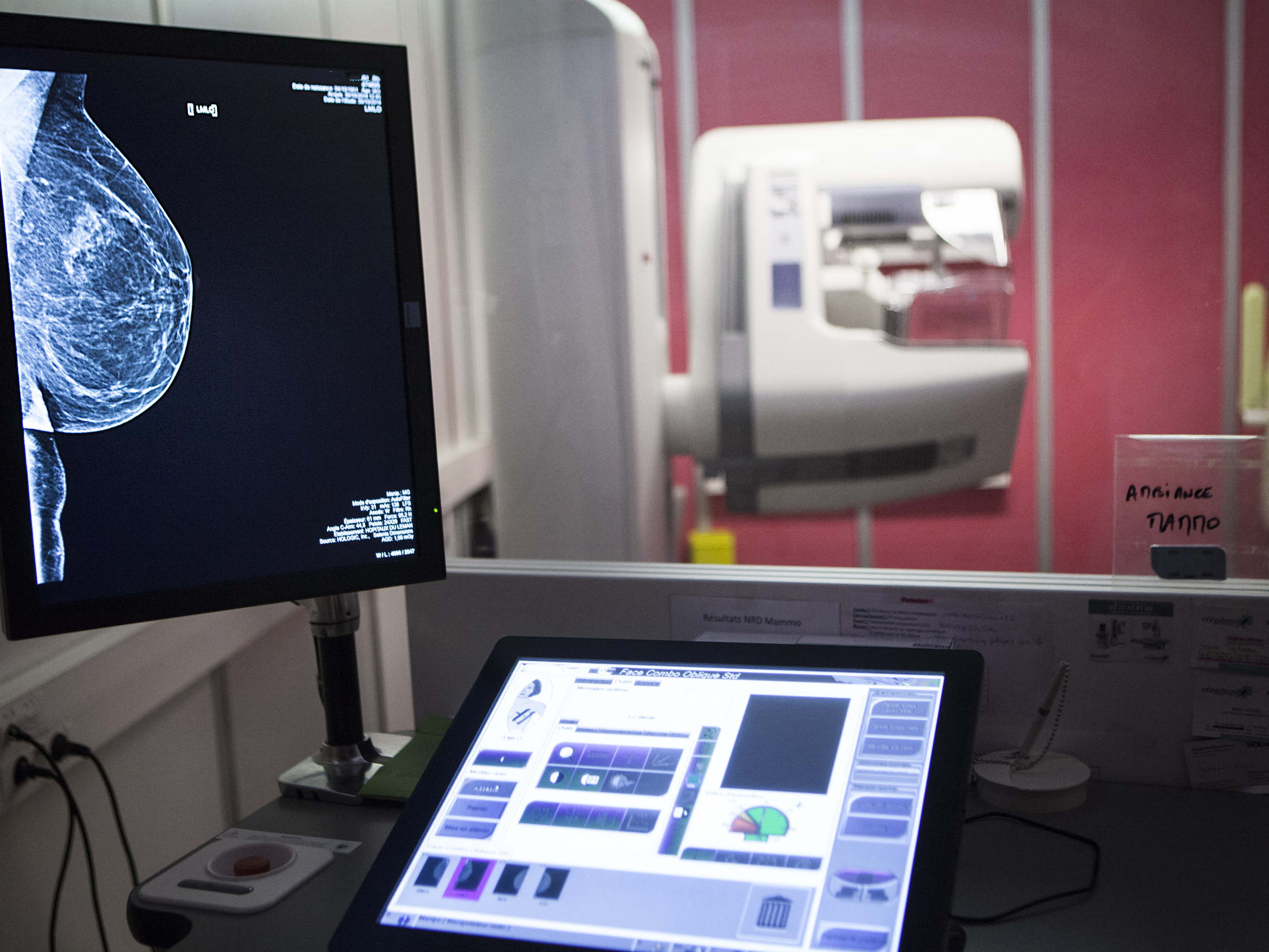 No breast cancer screening invitation for Brussels women due to absence new government