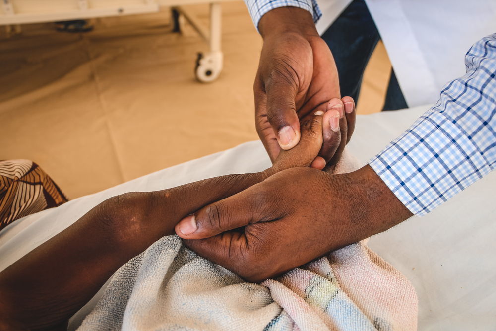 Paciente con desnutrición. Maiduguri, estado de Borno. Junio, 2022. © Nasir Ghafoor/MSF