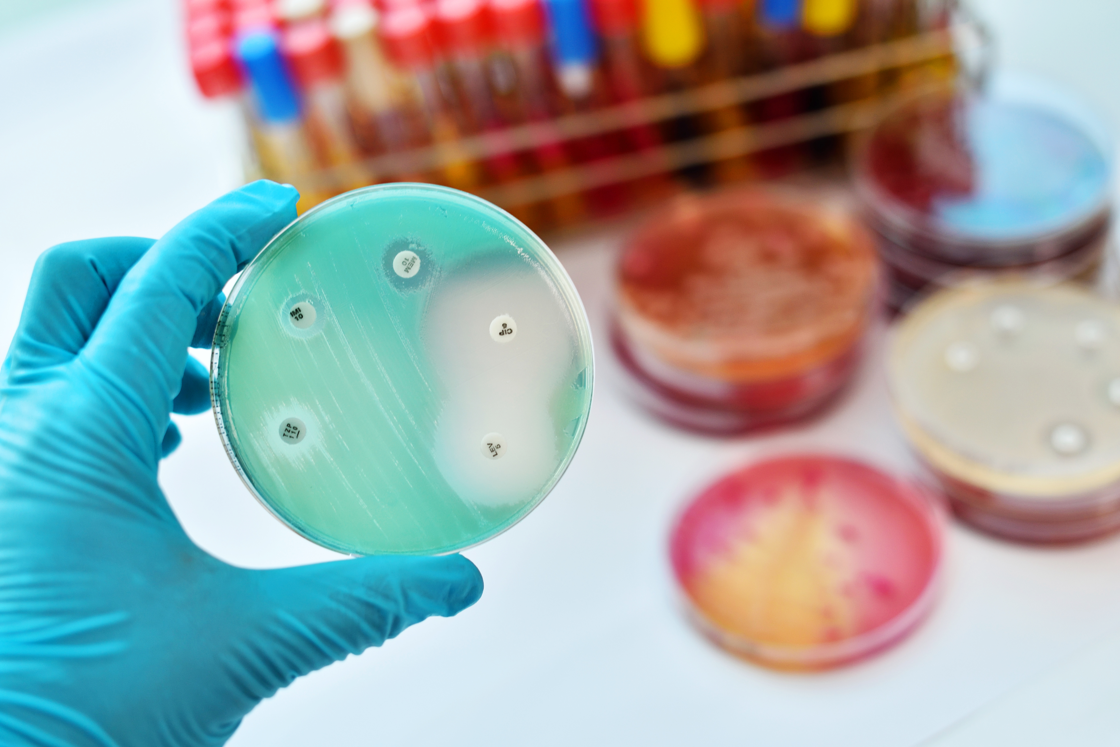 Waking up bacteria to overcome antibiotic resistance