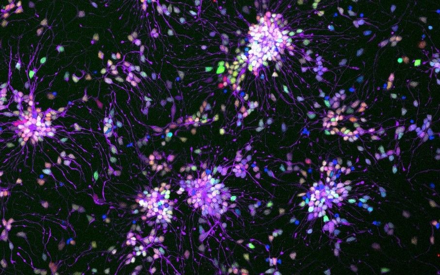 Human Stem Cell-Derived Neuronal Progenitors in vitro. Taken by Nóra Baligács from the Bart De Strooper Lab.