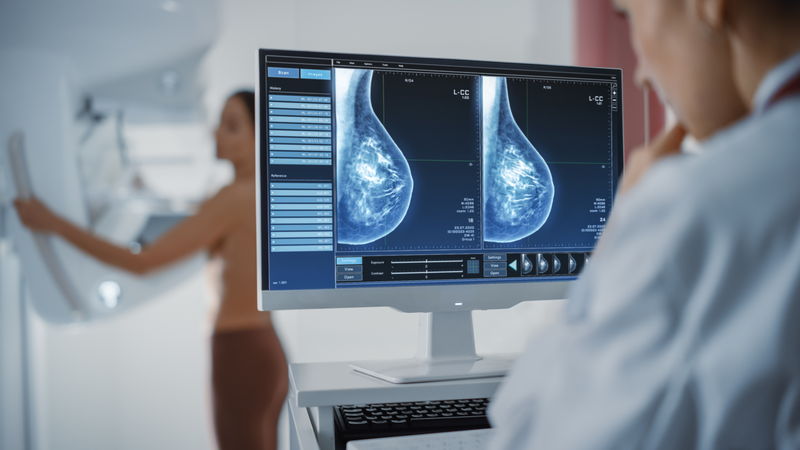 Een vrouw laat een mammografie (röntgenfoto) van een borst maken. (Foto: Shutterstock)