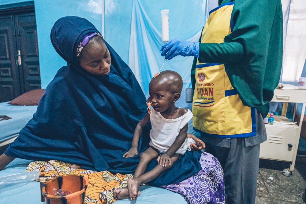 Abdulkadir, one year and five months, from Gadir, Sokoto state, has been diagnosed with lesions typical of the second stage of noma. Malnourished, he will be fed, and his wound dressed. Photographer: Fabrice Caterini. Date: 10/05/2023. Location: Nigeria Abdulkadir, one year and five months, from Gadir, Sokoto state, has been diagnosed with lesions typical of the second stage of noma. Malnourished, he will be fed, and his wound dressed. Photographer: Fabrice Caterini. Date: 10/05/2023. Location: Nigeria