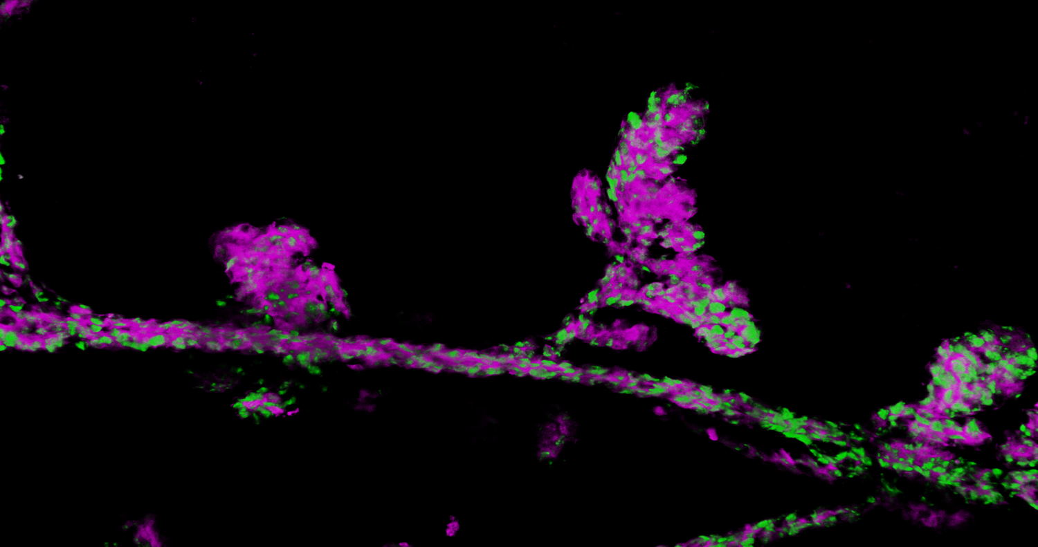 De oestruscyclus zorgt voor de expansie van gemuteerde cellen (in magenta en groen), wat leidt tot volledige kolonisatie van de normale melkgangen, waardoor deze gangen vatbaarder worden voor de vorming van kanker. Credit:VIB.