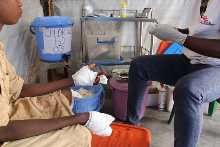 Young man receiving follow up treatment for gunshot wounds in MSF Out-patients clinic. “I was throwing stones at a mango tree to get some mangoes, not knowing that there were “bandits” resting on the tree. They shot me in both of my hands saying it would stop me from doing this again”. 