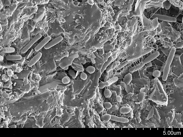 Microscopische weergave van bodembacteriën.