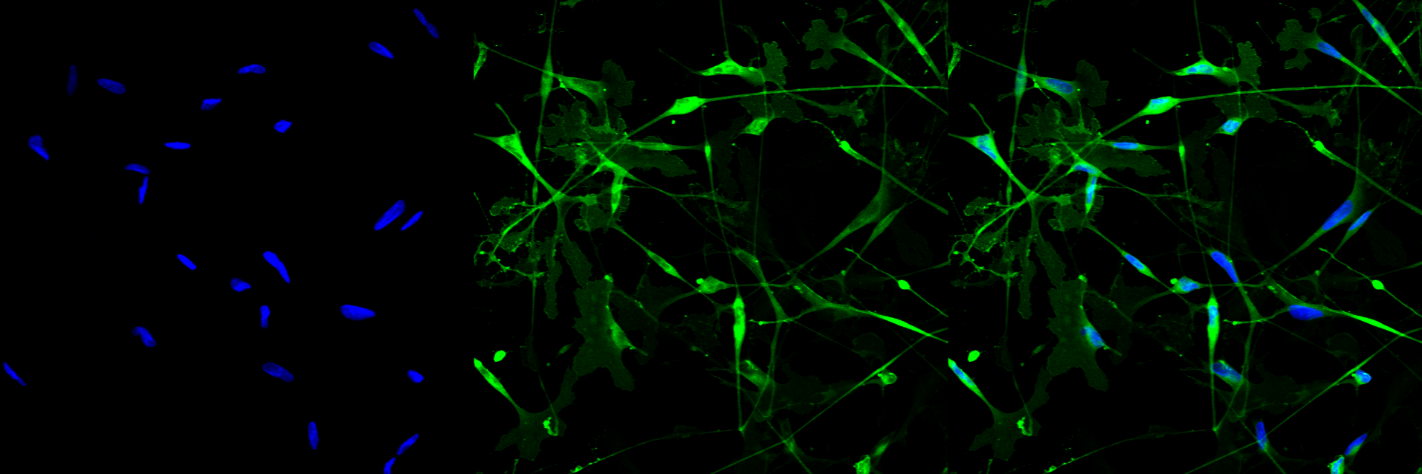 Primary human Schwann cells stained with NGFR-Brightfield of primary human Schwann cells. Credit: Robert Prior