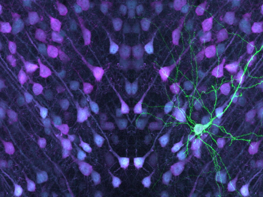 Research reveals unique features of brain cells linked to neurodevelopmental conditions