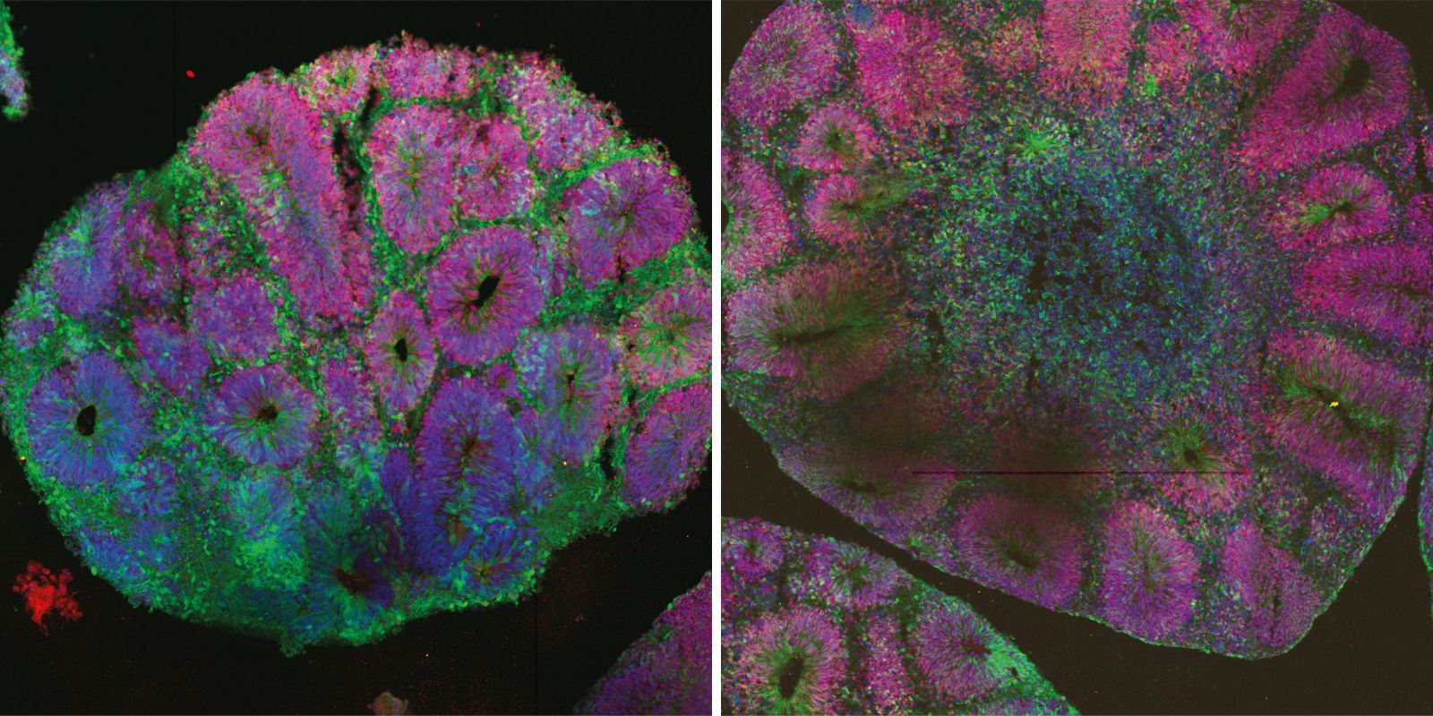 Human brain organoids