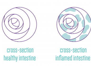 Little organisms, big impact: how microbes help us battle chronic Inflammatory Bowel Disease. 