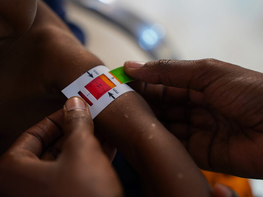 Somalia: la sequía y el déficit de financiación agravan la crisis de desnutrición
