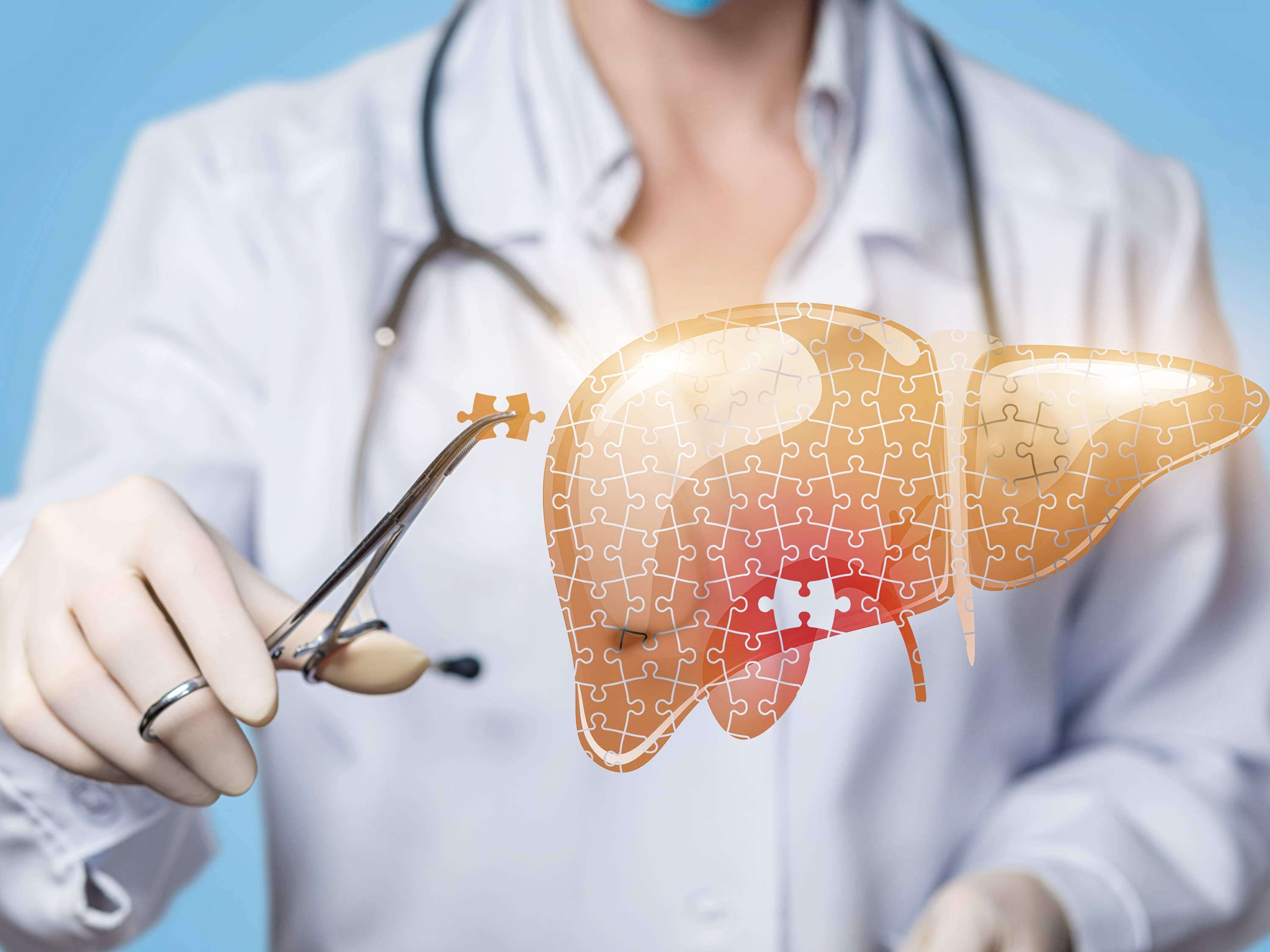 Gender personalized medicine: the future of fatty liver disease treatment