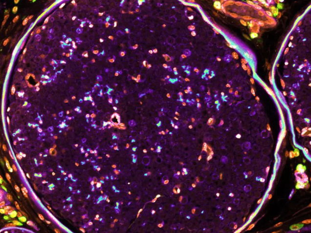 Reprogramming immune cells to improve cancer treatment