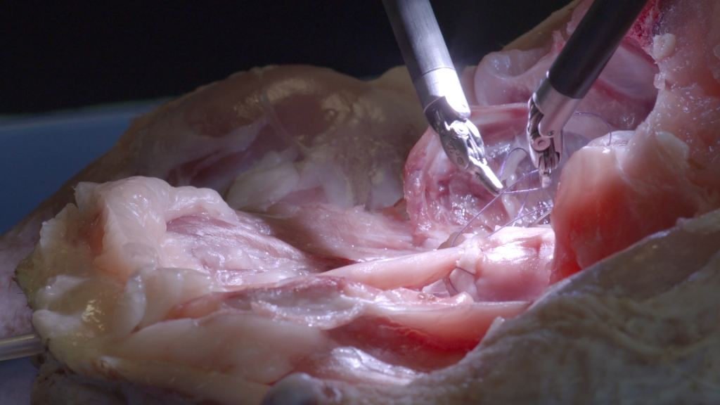 Koppen: robotchirurgie (c) VRT