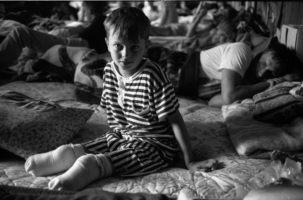 AKG9333664 Un petit garçon qui a perdu ses deux jambes à cause d'un bombardement, dans un hôpital de fortune construit par la Croix-Rouge près de Bihać en Bosnie-Herzégovine en 1995 © Emmanuel Ortiz / akg-images