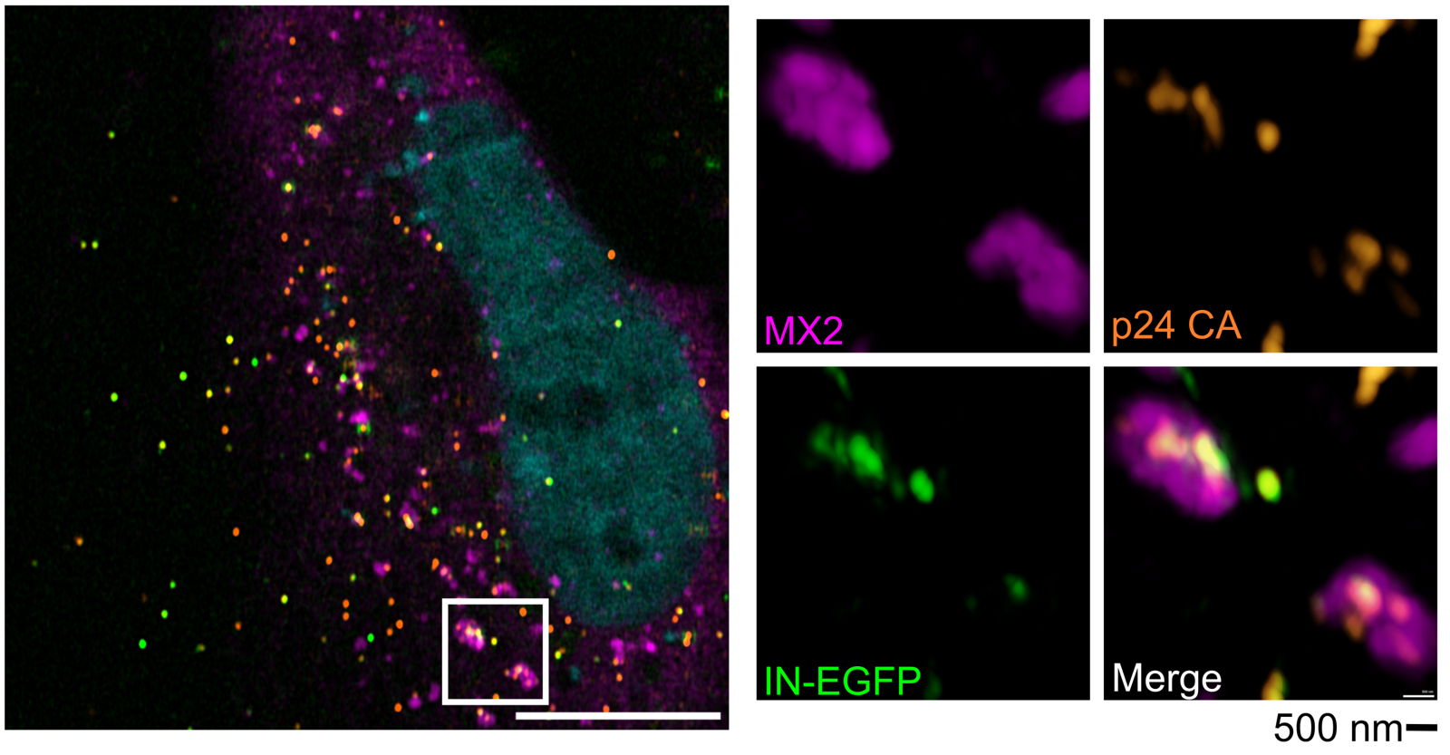 MX2 condensates (purple) trapping HIV-1 particles (orange and green).