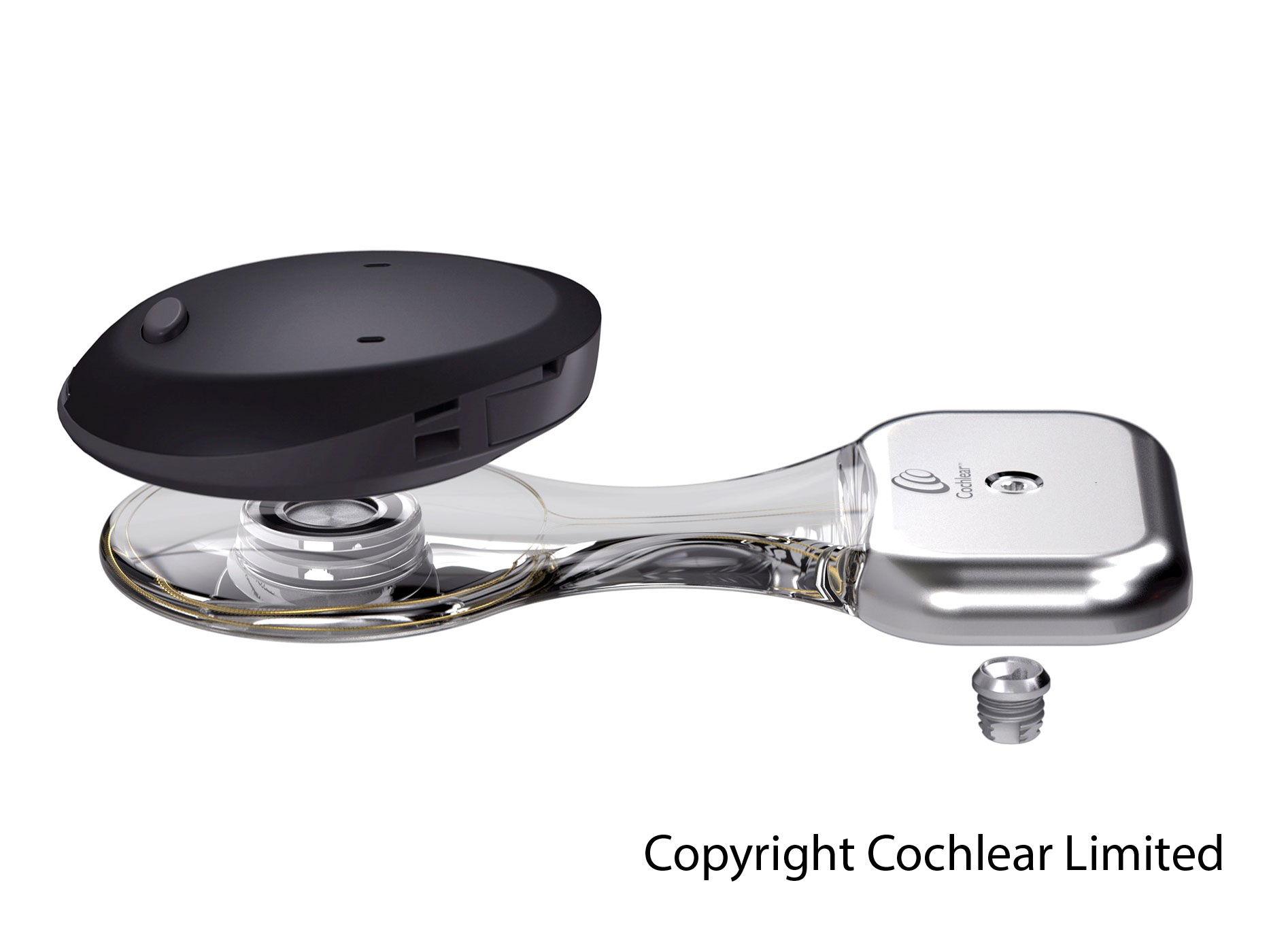 Het botverankerd hoortoestel bestaat uit een spoel met piëzo-elektrische transducer. Het wordt volledig onderhuids met een botimplantaat vastgezet in het bot. De geluidsprocessor (zwart) die aan de buitenkant zit, vangt geluiden en spraak op en stuurt deze draadloos versterkt door naar het implantaat. (Foto copyright Cochlear Limited) 