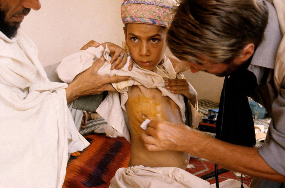 Un petit garçon afghan blessé est soigné par Bernard Kouchner des Médecins du Monde / Photo, 1984 © José Nicolas / akg-images