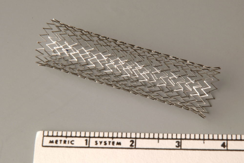 Een stent/ Copyright UZ Leuven