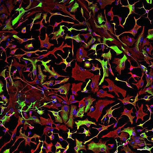 Humane astrocyten gekleurd met Vimentin (Vim, in rood) en de reactiviteitsmerker Glial fibrillary acidic protein (GFAP, in groen), geimaged door Christine Germeys.