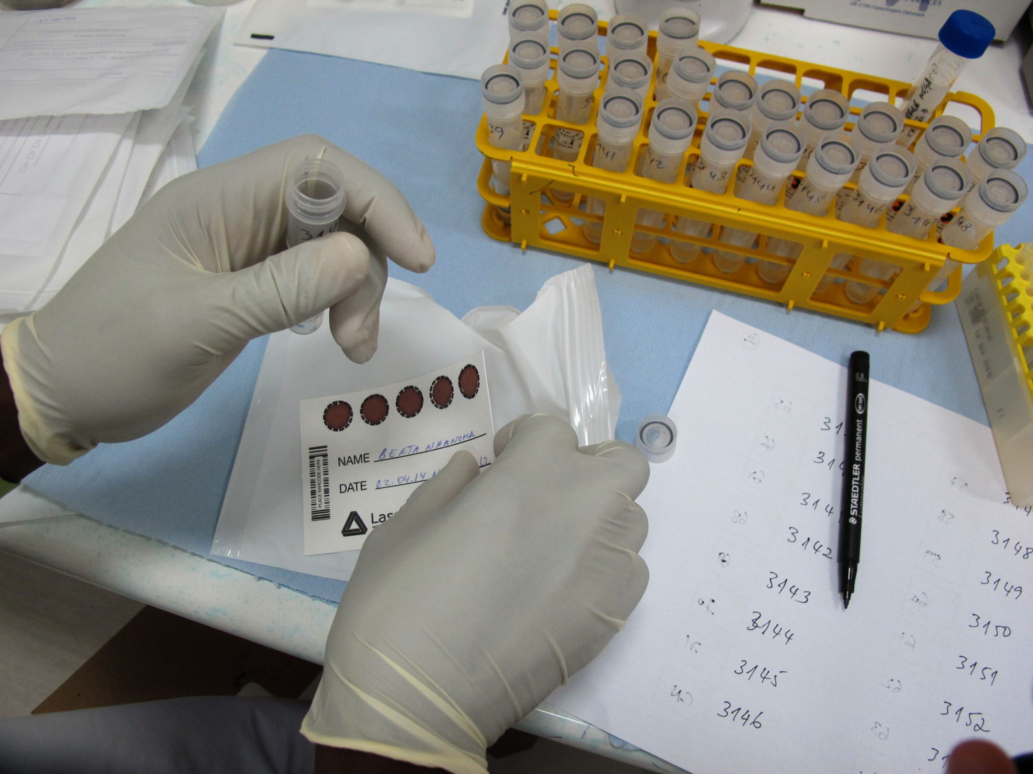 In Maputo, Mozambique, Jose Macamo hospital. Viral load monitoring has been used for years in Western countries, and is recommended by the World Health Organization as the gold standard of care for HIV. Contrary to the CD4 test that gives only an indirect indication of the disease’s progression, this technology calculates precisely how much virus is present in the patient’s body. It allows physicians to detect right away how well the ARV treatment is working, if the patient is not taking his drugs properly or has developed resistance to the first line of HIV drugs. Photographer:  Sarah-Eve Hammond