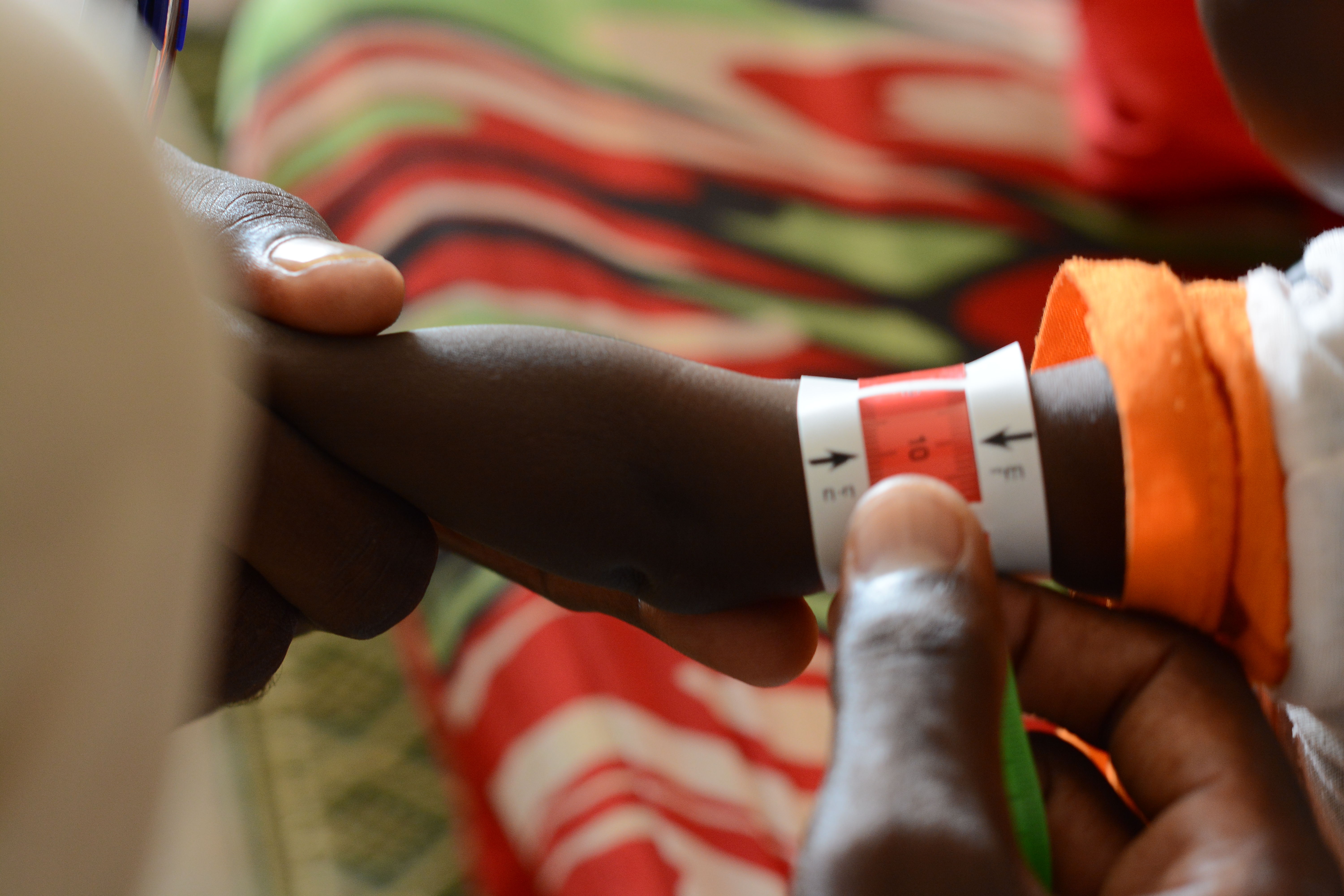 A child undergoes a MUAC screening in the ATFC at the MSF clinic in Zamzam Camp, North Darfur, a crucial step in diagnosing malnutrition. Zamzam camp near El-Fasher | 30/08/2024 | Photographer: Mohammed Jamal.