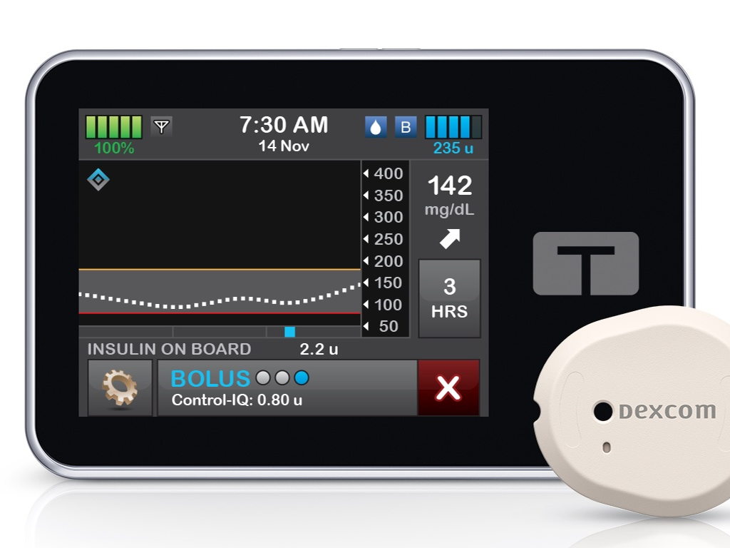 Dexcom G7 vanaf nu compatibel met Tandem t:slim X2