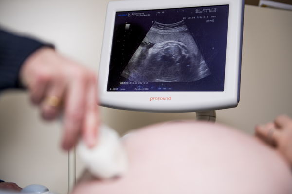 Belgian Justice minister proposes extending abortion limit to 14 weeks