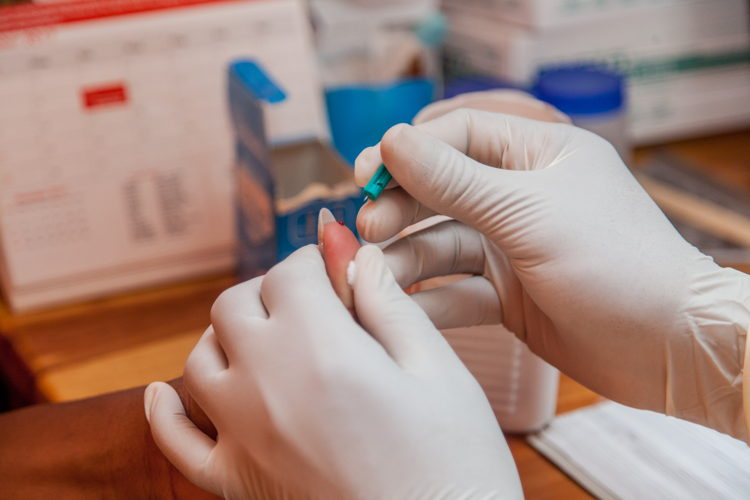 A nurse pricks a patient's finger during an HIV test. Photographer: Charmaine Chitate A nurse pricks a patient's finger during an HIV test. Photographer: Charmaine Chitate