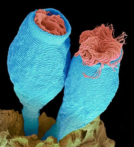 Vorticella. Micrographie électronique à balayage coloré (MEB). Ce protozoaire cilié se compose d'une tête en forme de cloche et d'une tige contractile qui est ancrée au substrat. Les cils (minuscules structures ressemblant à des cheveux, de couleur rouge) attachés à la tête sont utilisés pour capturer de la nourriture et aussi pour se déplacer. Grossissement : x1500 lorsque imprimé à 10 centimètres de large