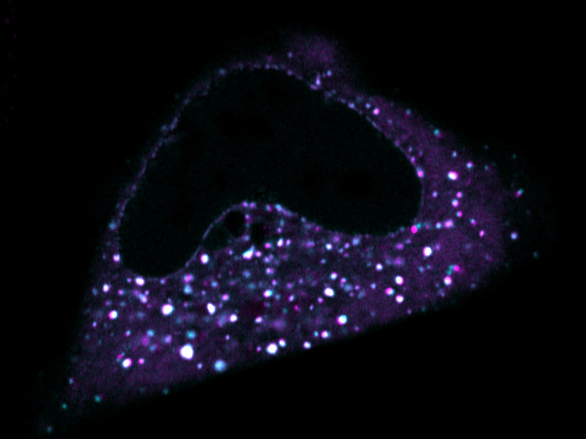Scientists discover viral trapdoor blocking HIV and herpes