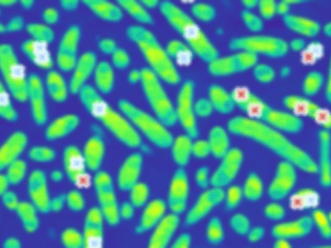 New study uncovers mechanisms of bacterial dormancy involving protein aggregation