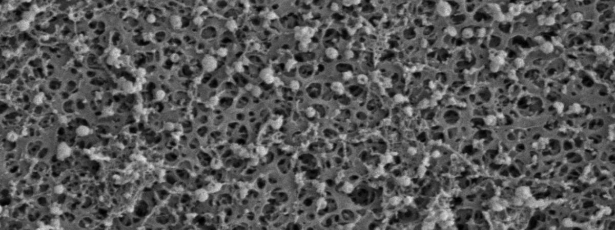 Platform Enhances Purity and Reproducibility of Extracellular Vesicle Proteomics