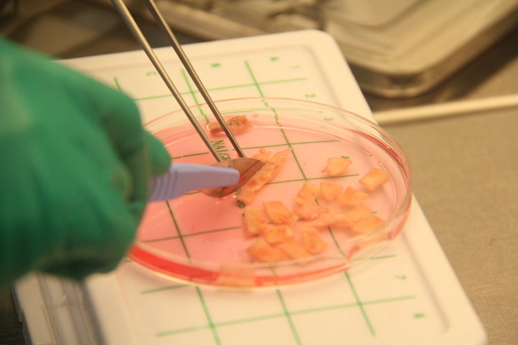 Processing ovarian tissue in the lab of the fertility clinic of the UZ Brussel Hospital