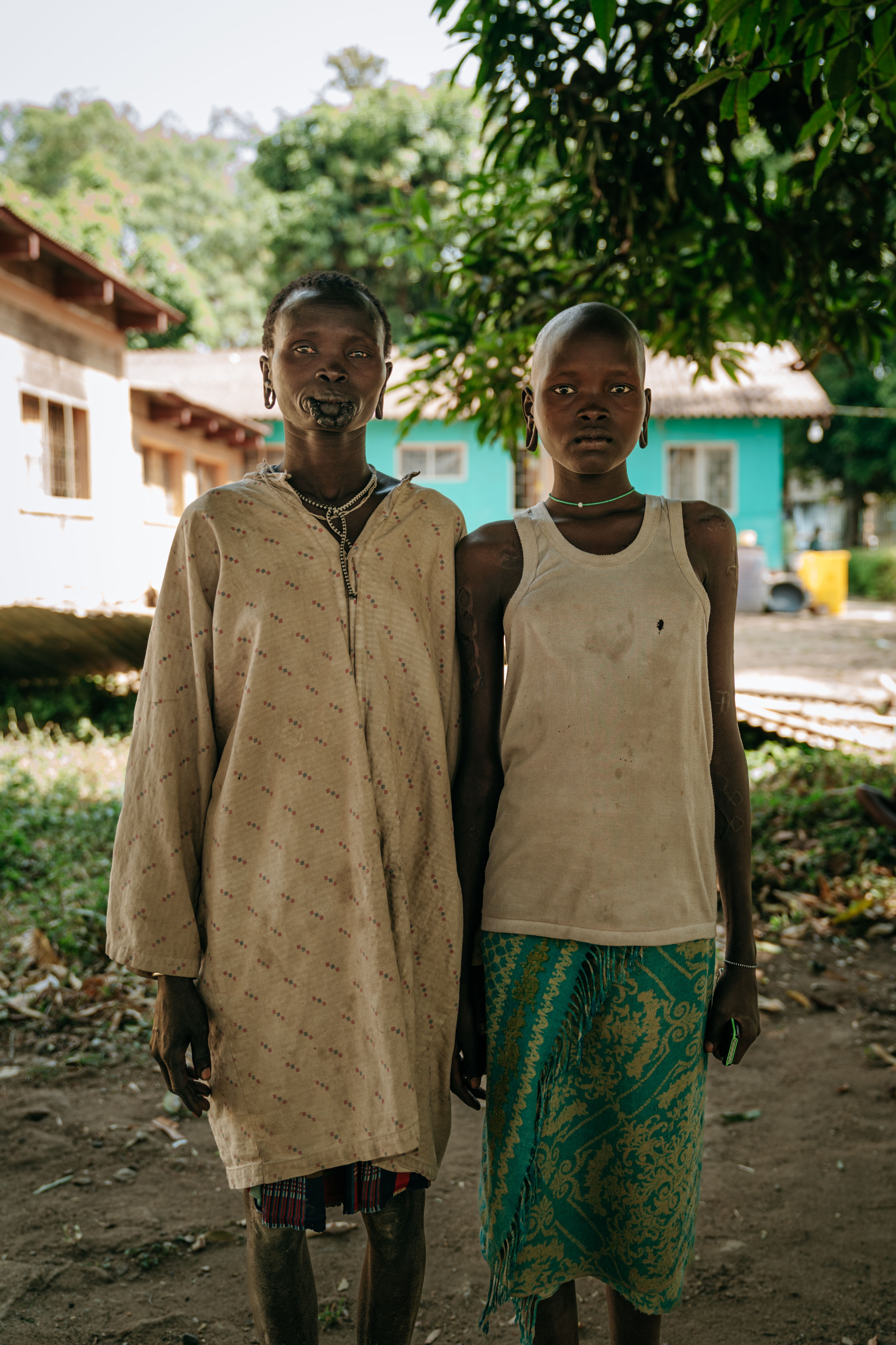 Shalalou and Kanke outside ​ of the Kala azar ward in Jinka.