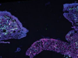 Cells that die during inflammation send wound-healing messages 